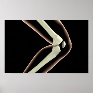 Röntgenstrahl-Bild von Knie 1 Poster