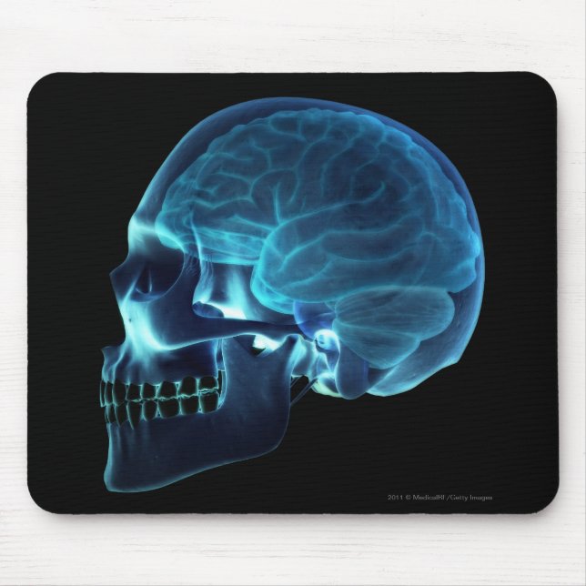 Röntgenstrahl des Gehirns innerhalb eines Schädels Mousepad (Vorne)