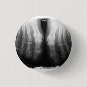 Röntgenstrahl-Fuß-menschliches Skeleton Button