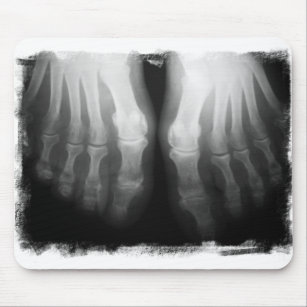 Röntgenstrahl-Fuß-menschliches Skeleton Mousepad