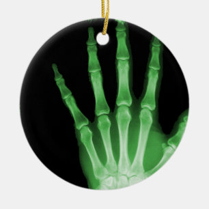RÖNTGENSTRAHL-SKELETON HANDfinger-GRÜN Keramik Ornament