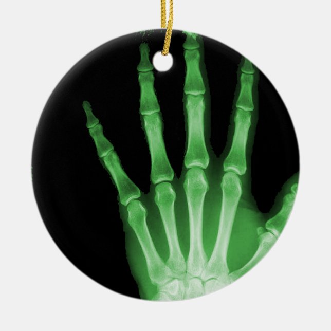 RÖNTGENSTRAHL-SKELETON HANDfinger-GRÜN Keramik Ornament (Vorne)