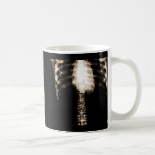 RÖNTGENSTRAHL-SKELETON TORSO-RIPPEN - SEPIA KAFFEETASSE