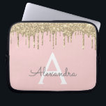 Rosa-Glitzer-Monogramm Laptopschutzhülle<br><div class="desc">Rosa und goldene Imitat treiben Moderne und Elegante Girly Glitzer und sparkle elegante Monogram Case. Dieser Fall kann so angepasst werden,  dass er Ihren Anfangs- und Vornamen enthält.</div>
