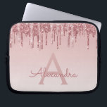 Rosa-Glitzer und Sparklogramm Laptopschutzhülle<br><div class="desc">Blush Pink - Rose Gold Imitate Dripping Glitzer und sparkle elegante Monogram Laptop Gehäuse. Dieser mit Monogramm Fall kann so angepasst werden,  dass er Ihren Anfangs- und Vornamen enthält.</div>