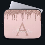 Rosa Rose Gold Glitzer Sparkone Monogramm Laptopschutzhülle<br><div class="desc">Blush Pink - Rose Gold Imitats Dripping Modern and Elegant Girly Glitzer and Sparkle Elegant Monogram Case. Dieser Fall kann so angepasst werden,  dass er Ihren Anfangs- und Vornamen enthält.</div>