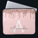 Rosa Rose Gold Glitzer Sparkone Monogramm Laptopschutzhülle<br><div class="desc">Blush Pink - Rose Gold Imitats Dripping Modern and Elegant Girly Glitzer and Sparkle Elegant Monogram Case. Dieser Fall kann so angepasst werden,  dass er Ihren Anfangs- und Vornamen enthält.</div>