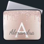 Rosa Rose Gold Metallischer Glitzer Monogramm Laptopschutzhülle<br><div class="desc">Rosa Rose Gold Glitzer und glatter,  moderner und eleganter Monogramm-Case. Dieses Gehäuse kann auf Ihren Anfangs- und Vornamen angepasst werden und macht ein großartiges mädchenhaftes oder süßes 16 Geburtstagsgeschenk.</div>