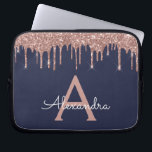 Rosa Rose Gold Navy Blue Glitzer Sparkgram Monogra Laptopschutzhülle<br><div class="desc">Rosa Rose Gold und Navy Blue Imitate Dripping Modern and Elegant Girly Glitzer and Sparkle Elegant Monogram Case. Dieser Fall kann so angepasst werden,  dass er Ihren Anfangs- und Vornamen enthält.</div>