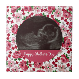 Rosa Rosen Custom Ultrasound Mutter Day Tile Fliese