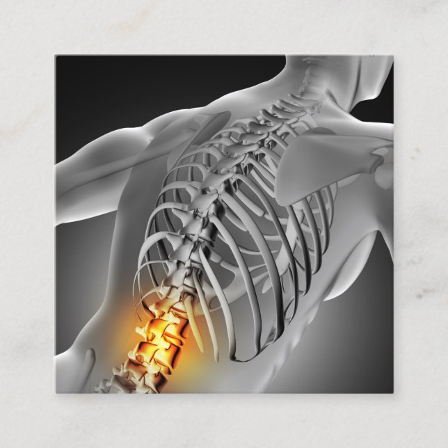 Rücken Schmerzen Foto Graphic Square Chiropractic Quadratische Visitenkarte (Vorderseite)