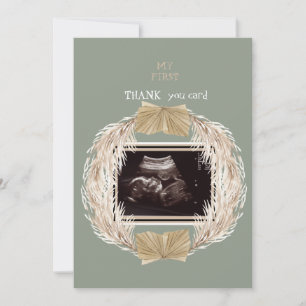 Sage Ultrasound Photo Merci Baby Point de vue