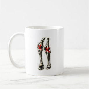 Schlechte Knie – Lustige Skelett-Knie-Illustration Kaffeetasse