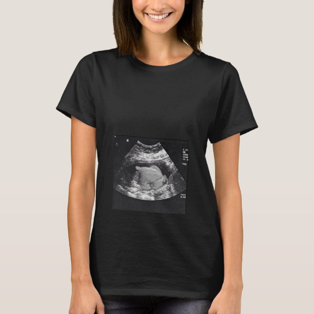 SCHWANGERE TÜRKEI ULTRASOUND T-Shirt (Vorderseite)