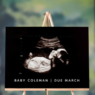 Schwangerschaft Ankündigung Baby Dusche Sonogramm Acrylschild
