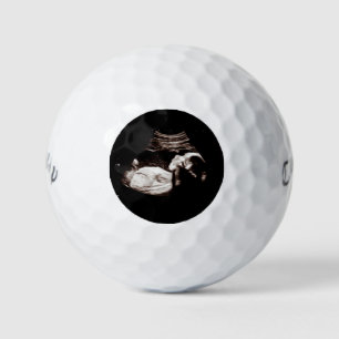 Schwangerschaft Baby Sonogram Ultraschall Foto Män Golfball