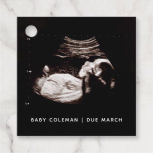 Schwangerschaft Baby Sonogram Ultraschallgerät Fot Geschenkanhänger