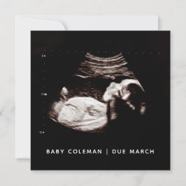 Schwangerschaft Baby Sonogramm Ultraschallfotokart