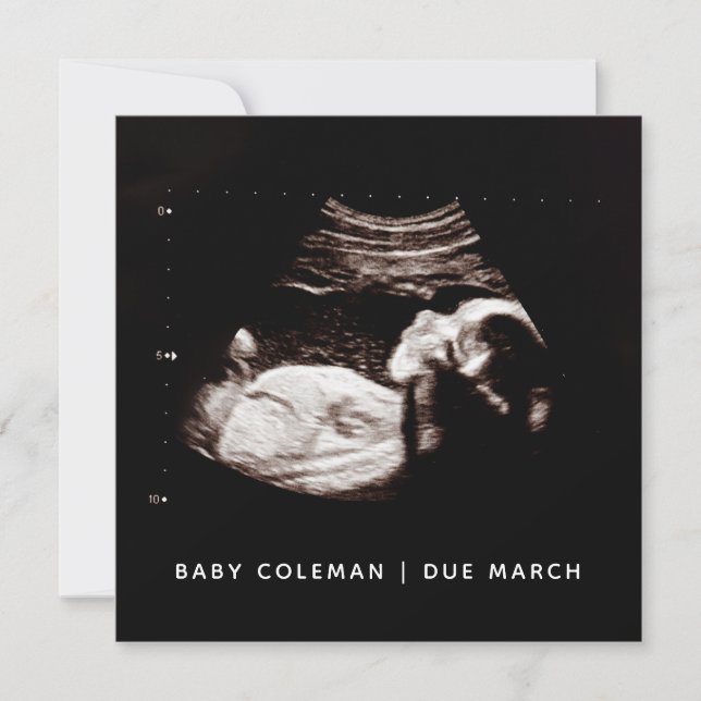 Schwangerschaft Baby Sonogramm Ultraschallfotokart (Vorderseite)