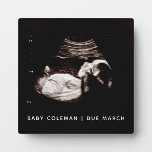 Schwangerschaft Baby Sonogramm Ultraschalluntersuc Fotoplatte