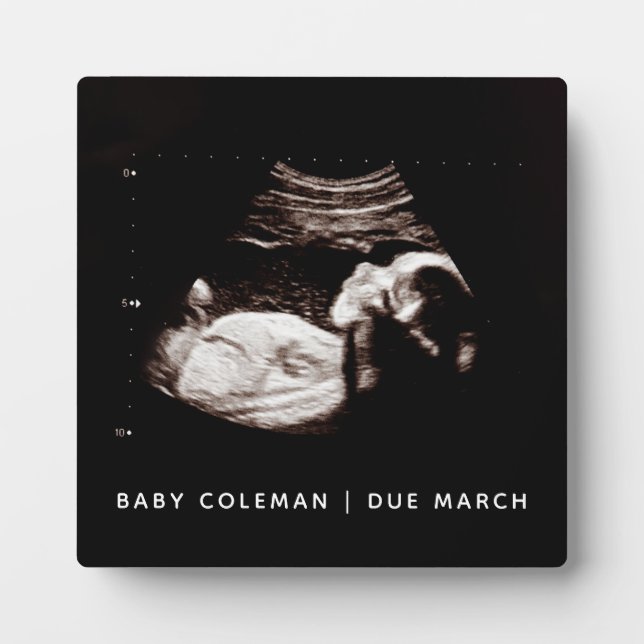 Schwangerschaft Baby Sonogramm Ultraschalluntersuc Fotoplatte (Vorderseite)