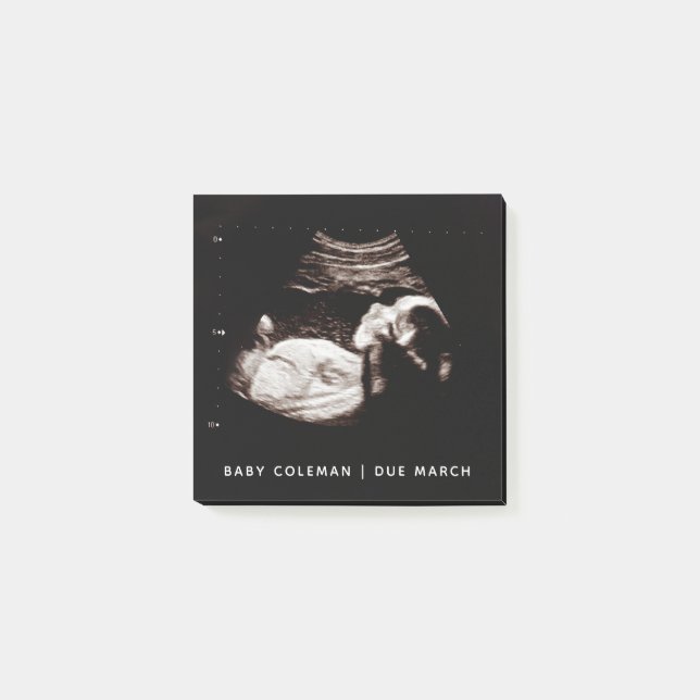 Schwangerschaft Baby Sonogramm Ultrasound Foto Post-it Klebezettel (Vorderseite)