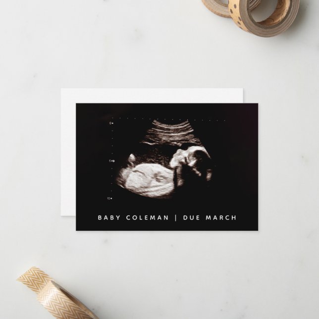 Schwangerschaft Reveal Baby Ultrasound Sonogramm F Mitteilungskarte (Vorderseite/Rückseite Beispiel)