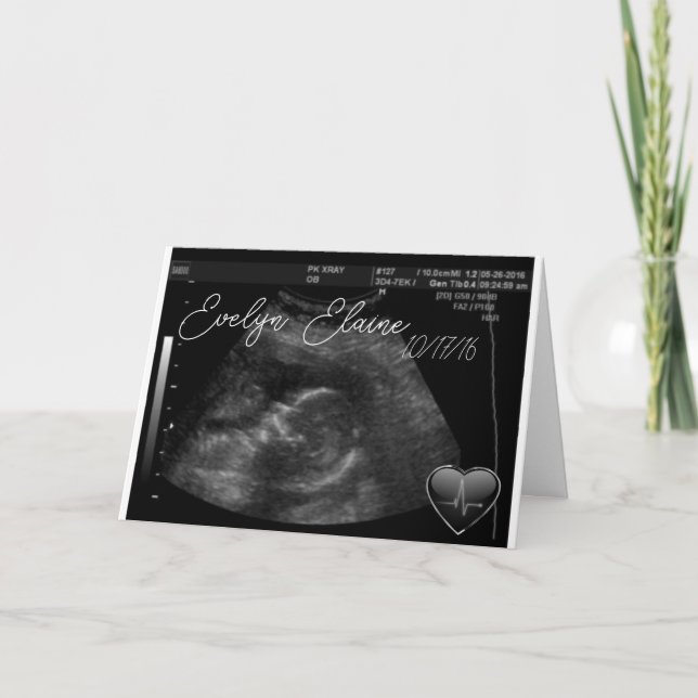 Schwangerschaft Sonogram Baby niedlich anpassbar Karte (Vorderseite)