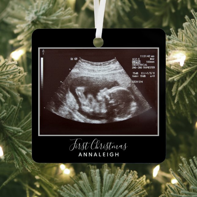Schwangerschaft Ultrasound Foto Erster Weihnachtsf Ornament Aus Metall (InSitu)