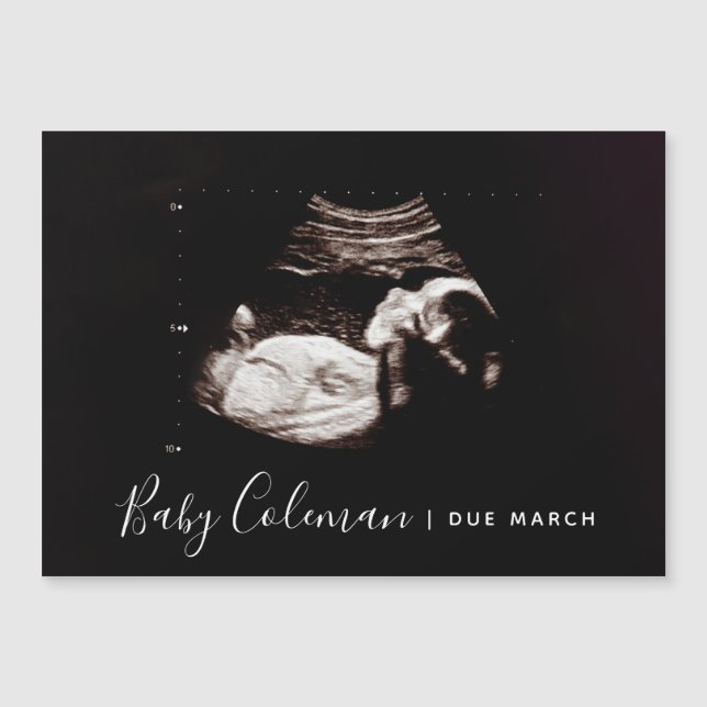 Schwangerschaftsankündigung Sonogram Name Magnet (Vorderseite)