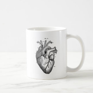 Schwarzes anatomisches Herz Kaffeetasse