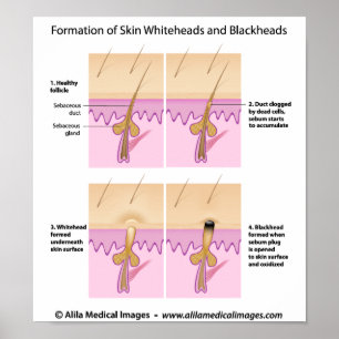 Schwarzkopfplakat Poster