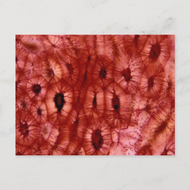 Sclerenchyma Zellen aus der Kirschgrube Postkarte (Vorderseite)