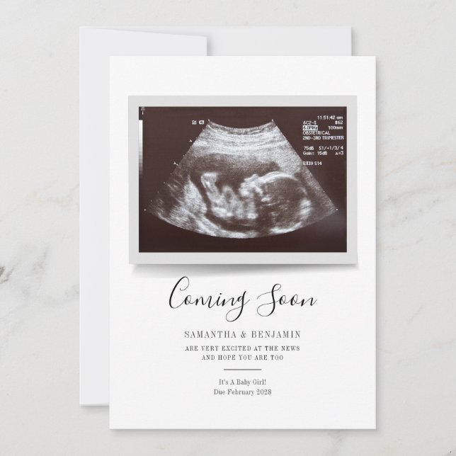 Script Sonogram Kommt bald Schwangerschaftsankündi (Vorderseite)