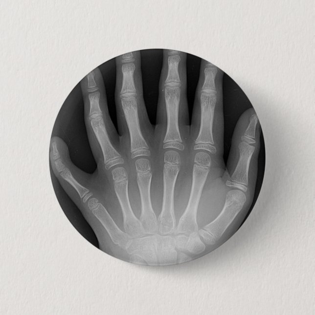 Sechs fingrige Hand, medizinische Rarität, Button (Vorderseite)