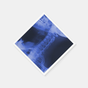 Serviettes En Papier Bleu 2 électromagnétique radiographié