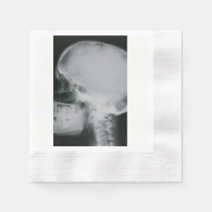 Serviettes Jetables Crâne de rayon X