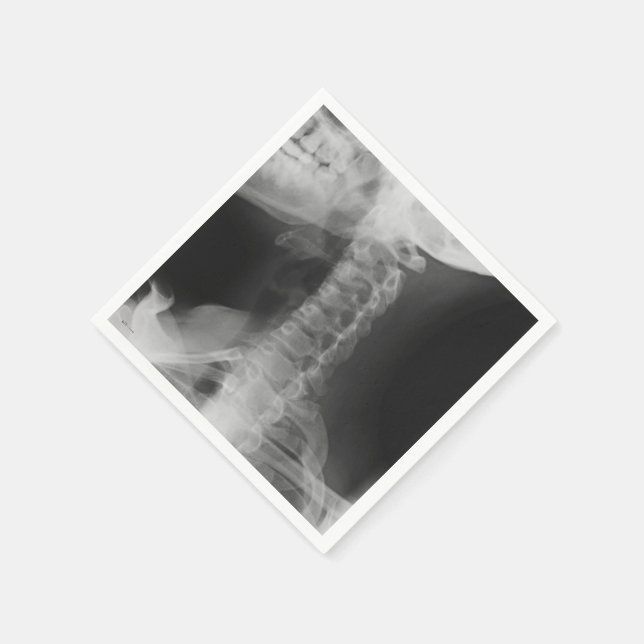 Serviettes Jetables X-Rayed 2 (Original) (Coin)