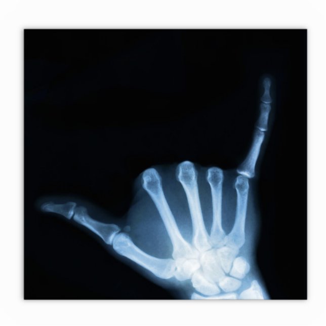Shaka Sign X-Ray (Hang Loose) Freistehende Fotoskulptur (Vorne)