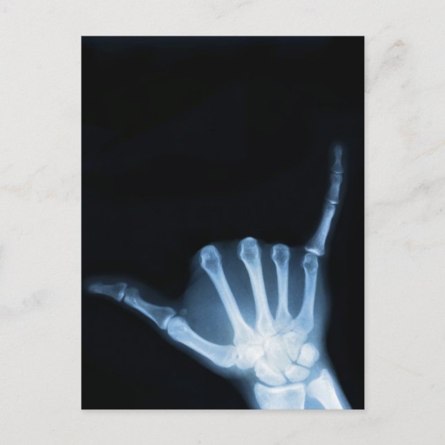 Shaka Sign X-Ray (Hang Loose) Postkarte (Vorderseite)