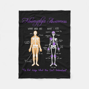 Sie sehen, was ich fühle Skeletton Fibromyalgie Aw Fleecedecke