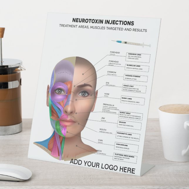 Signe De Table Points d'injection de neurotoxine (In SItu)