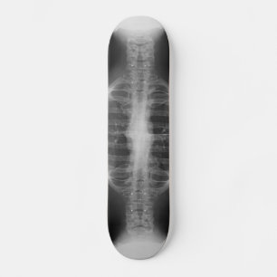 Skateboard 3 radiographiés