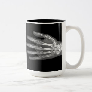 Skeleton Hand X-Ray Zweifarbige Tasse