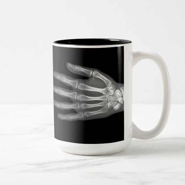 Skeleton Hand X-Ray Zweifarbige Tasse (Rechts)