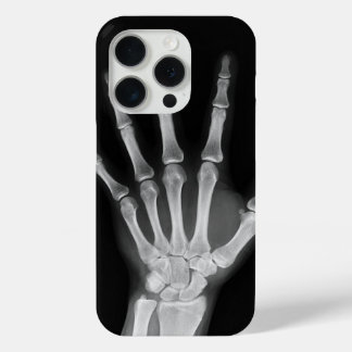 Skeleton iPhone 15 pro Cover