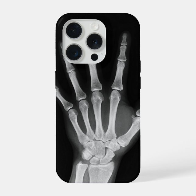 Skeleton iPhone 15 Pro-Hülle Pro Hülle (Rückseite)