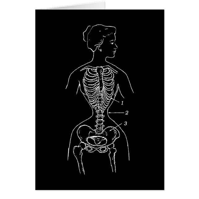 Skelett und Corset (Vorne)