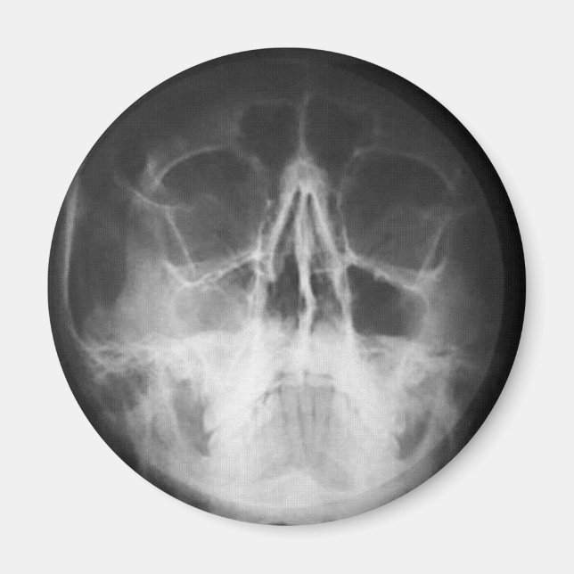 Skully Top Fun Magnet (Vorne)