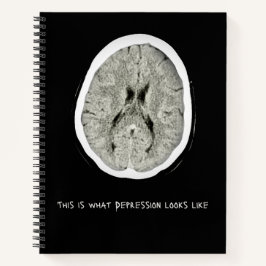 So sieht Depressionen aus.CTFOD Notizbuch